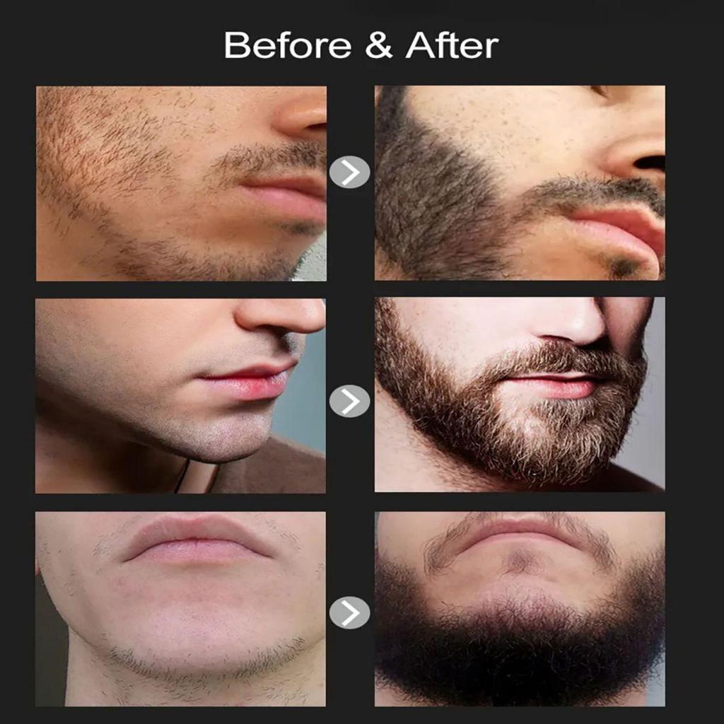 Fast Beard Growth Oil Beard Oil for Men Caffeine Natural Beard Growth Serum Promote Hair Regrowth Professional Brazilian Keratin