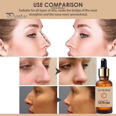30 ml Nasenreparaturserum, straffende Massage, sanfte Inhaltsstoffe, sorgen für eine dreidimensionale Nasenform-Essenz