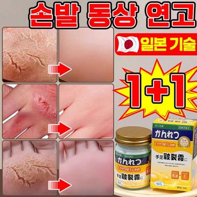 1+1 Hands and Feet Frostbite Ointment Winter Frostbite Prevention Cream  50g, 2 Pieces