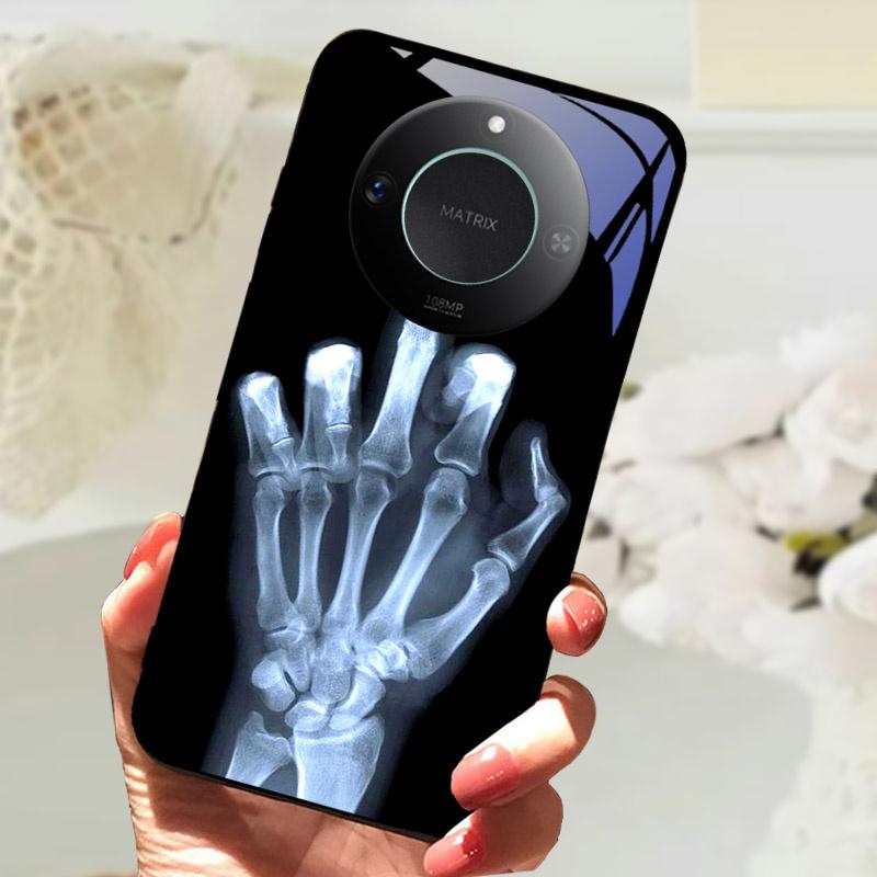 For Honor X9C Smart Case Cover Fashion Luxury Cool Animals Painted Fundas For Honor X9C Smart Tempered Glass Phone Back Shell