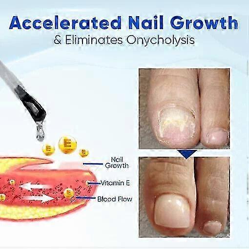 3 Stück Nagelwachstums- und Reparaturserum.Onyxoguard Nagelwachstum und Stärker 15ML