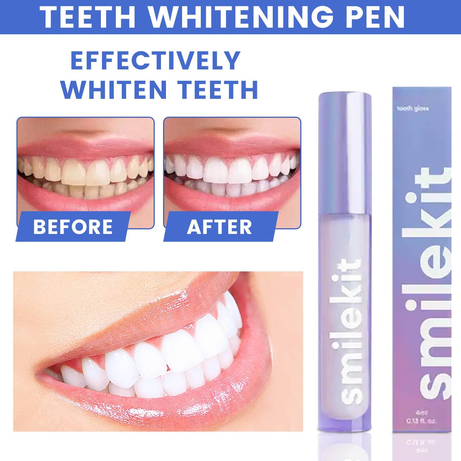 

Teeth Whitening Pen Beauty Teeth Pen Set Beauty Teeth Gel Tooth Cleaning Pen Gloss Agent 10ml