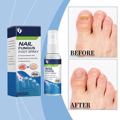 Foot Odor SprayAntibacterial Deodorant PowderAnti Itch Sweat Odor Feet Athletes Foot Liquid Anti-Fungi Shoe Sock Feet Care