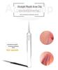 Stainless Steel Ultra-Fine Pimple Tweezers - Super Sharp Acne & Blackhead Removal Tool for Beauty Care
