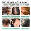 Rosemary Oil for Hair, 60ml Organic Rosemary Oil Undiluted, 100% Natural Pure Rosemary Hair Oil, Rosemary Oil for Scalp and Hair