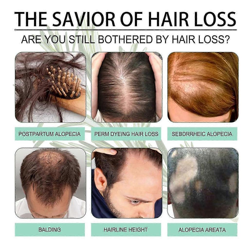Rosemary Oil for Hair, 60ml Organic Rosemary Oil Undiluted, 100% Natural Pure Rosemary Hair Oil, Rosemary Oil for Scalp and Hair