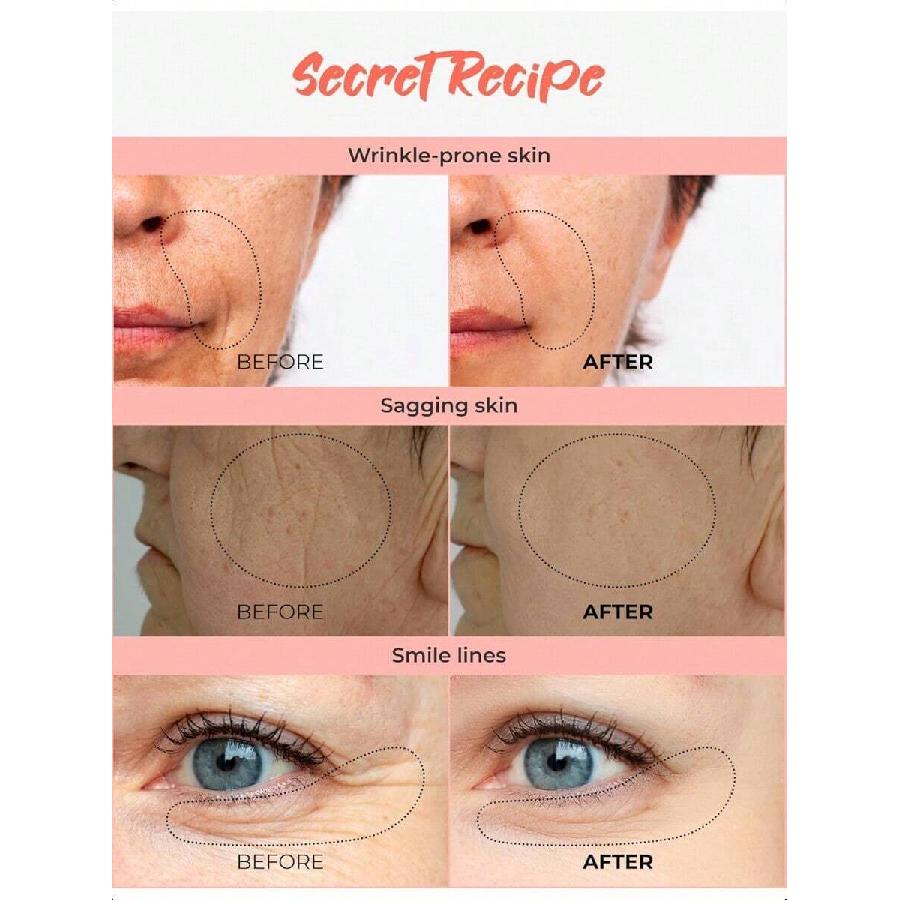 Banobagi Anti-Oxidant Booster Mask 5EA| Korean Collagen Hydrating Face Masks | Beauty Collagen Face Mask Sheet Set | Moisturizing Face Mask Skincare