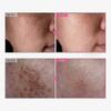 3pcs Arbutin 7% + Tranexamic Acid 4% Cream 50g, Fades Hyperpigmentation, Evens Skin Tone, Hydrating For All Skin Types