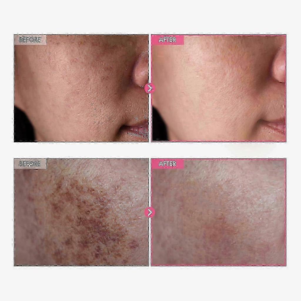 3pcs Arbutin 7% + Tranexamic Acid 4% Cream 50g, Fades Hyperpigmentation, Evens Skin Tone, Hydrating For All Skin Types
