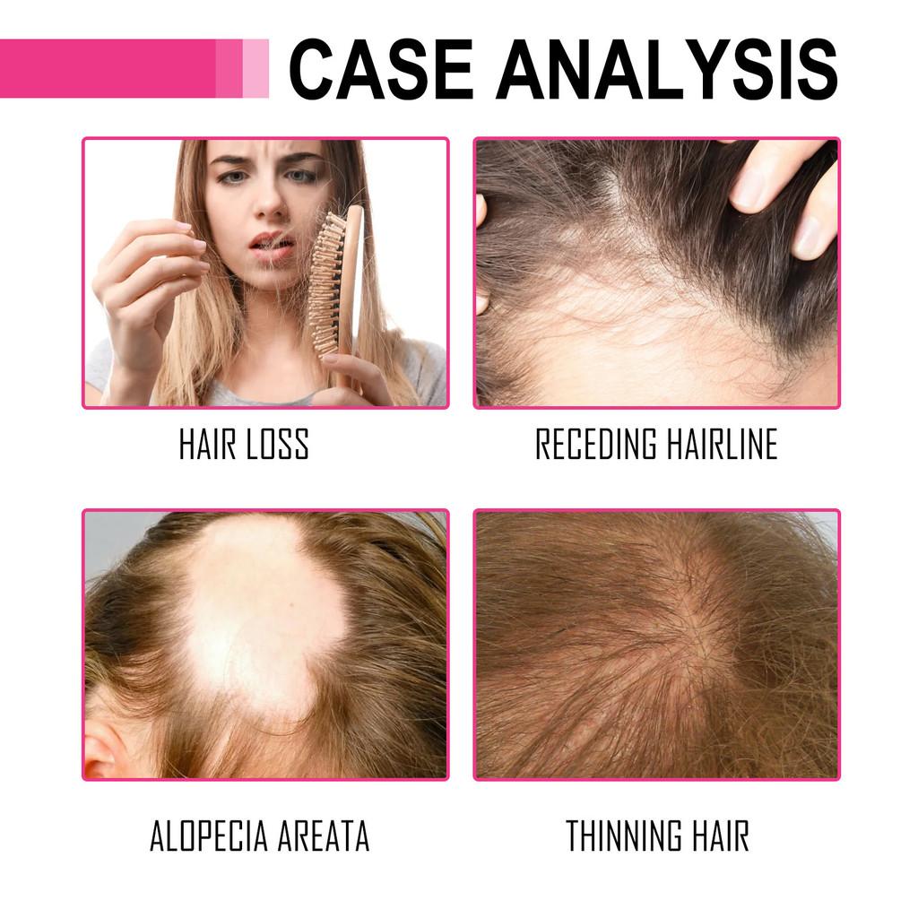 Hoegoa Nourishing Hair Oil For Hydrating And Repairing Dry And Frizzy Hair Ends