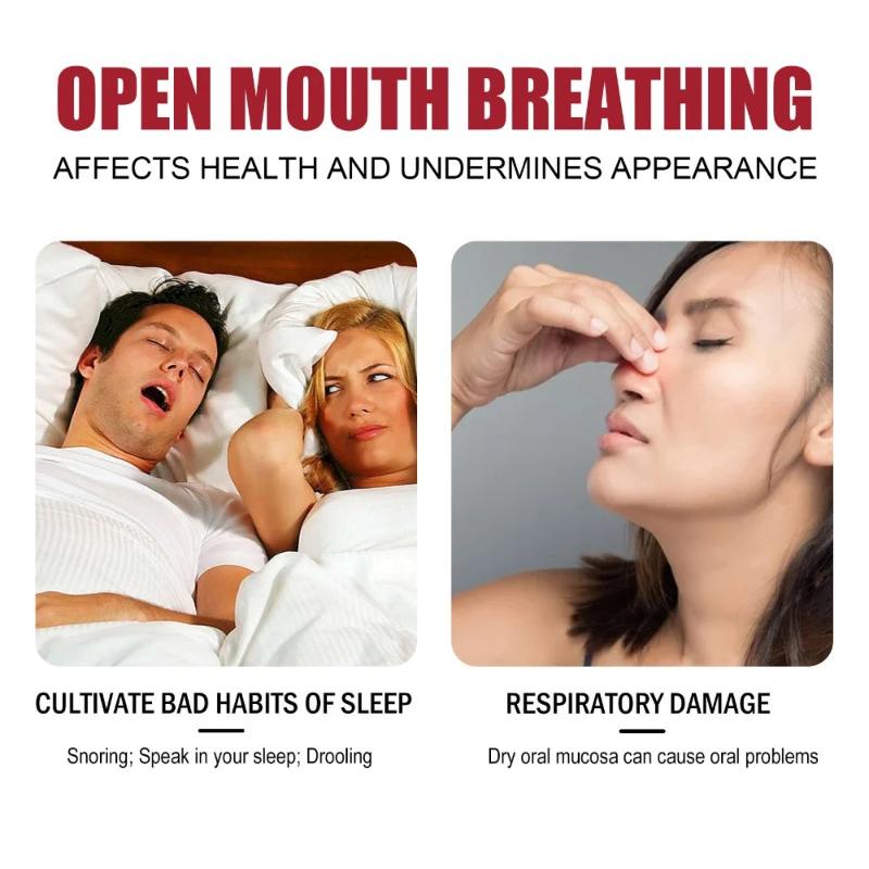 respiratory care anti snoring device to prevent snoring at night, orthodontic braces to prevent snoring and ensure stable sleep