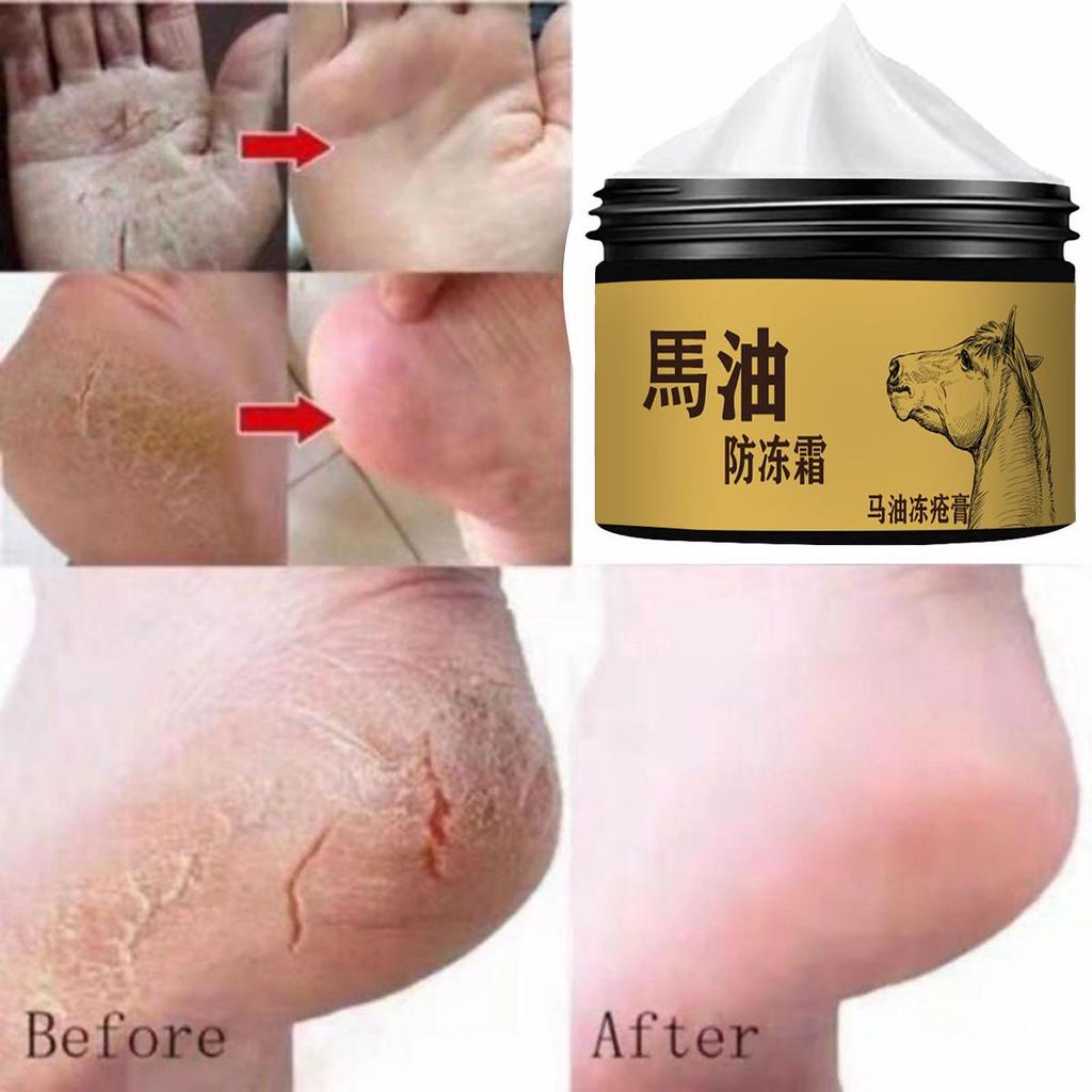 Horse Oil Antifreeze Cream, Hydrating and Moisturizing, Repairing Damaged, Dry and Cracked Skin, Caring for Skin with Horse Oil Frostbite Cream