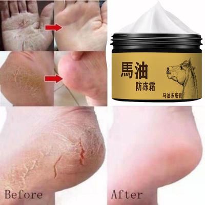 Crème antigel à l'huile de cheval, hydratante et hydratante, réparatrice de la peau abîmée, sèche et craquelée, soin de la peau avec crème antigel à l'huile de cheval