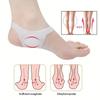 Feet Care Pain Relief Foot Support Tool Flatfoot Correction Arch Orthotic Insole Orthopedic Pad Plantar Fasciitis Feet Cushion