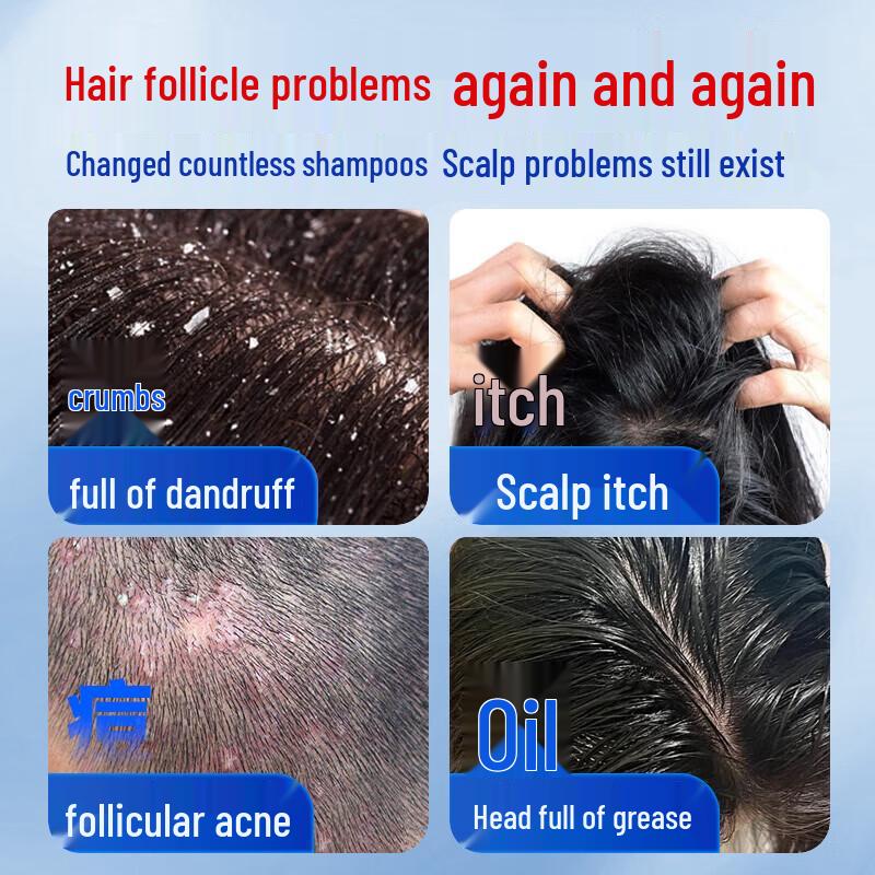 Renhejiangxin Follicle Cleansing Anti-Dandruff Selenium Sulfide Shampoo