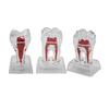With Base Decomposable Dental Teeth Model Separable Detachable Tooth Disintegration Ornaments Transparent Single Tooth