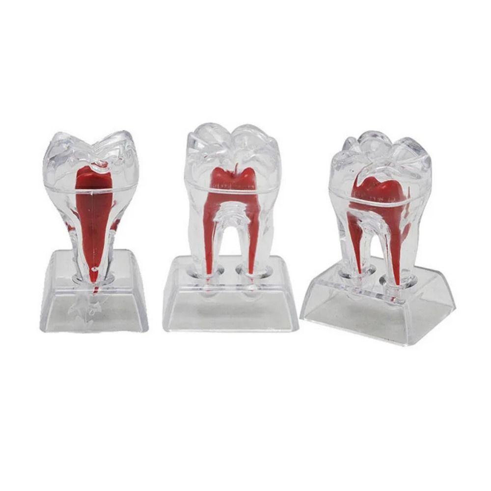 With Base Decomposable Dental Teeth Model Separable Detachable Tooth Disintegration Ornaments Transparent Single Tooth