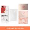MEJISOO Anti-Acne Hydrocolloid Patches - 36 Invisible Acne Patches for Cross-Border Trade