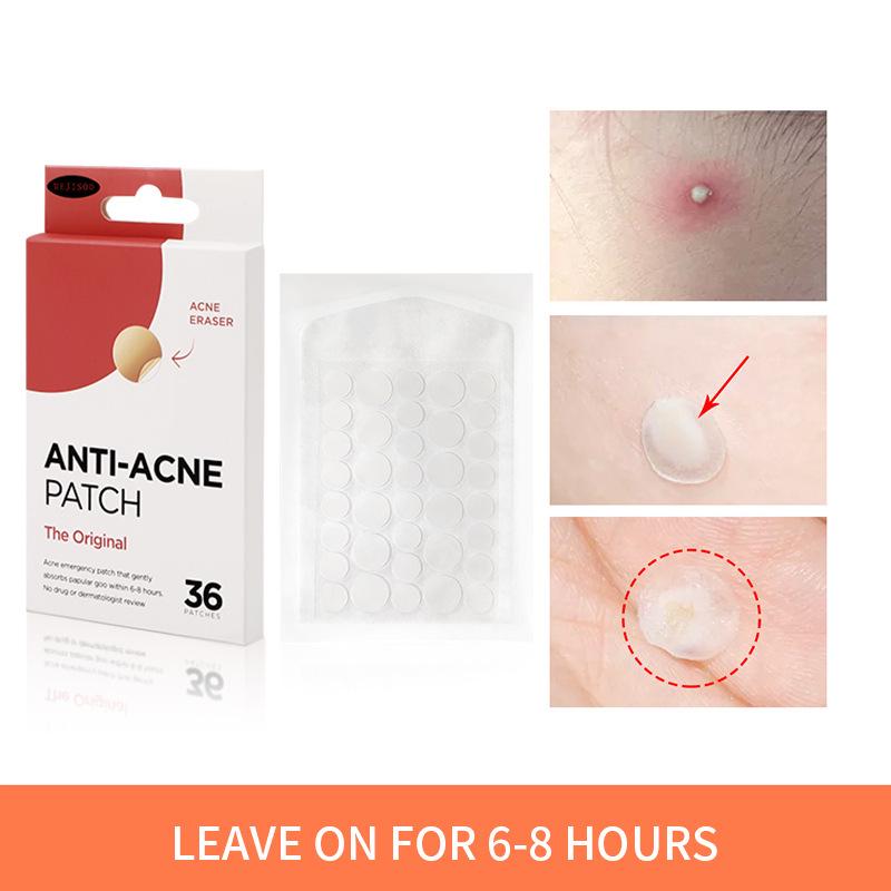 MEJISOO Anti-Acne Hydrocolloid Patches - 36 Invisible Acne Patches for Cross-Border Trade