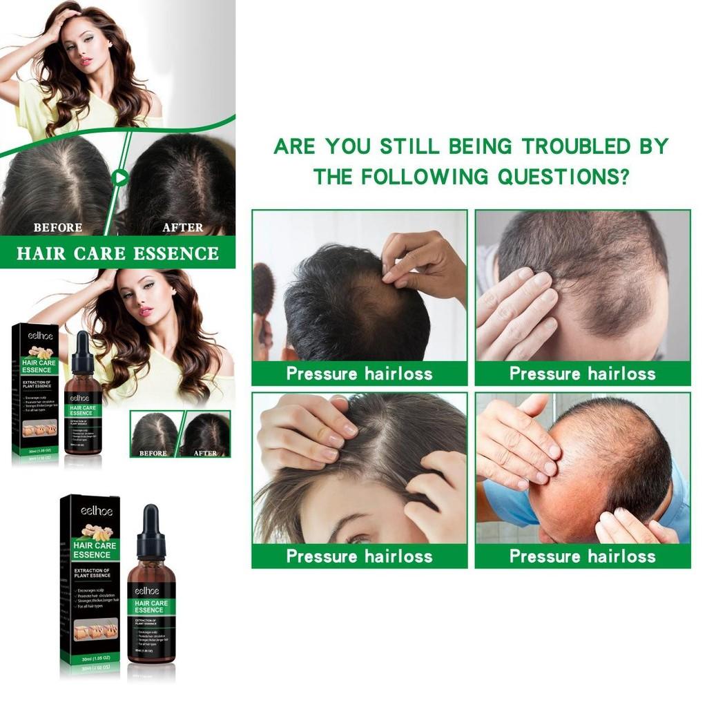 Eelhoe Ginger Hair Essence Strengthening Serum For Thicker And Healthier Hair