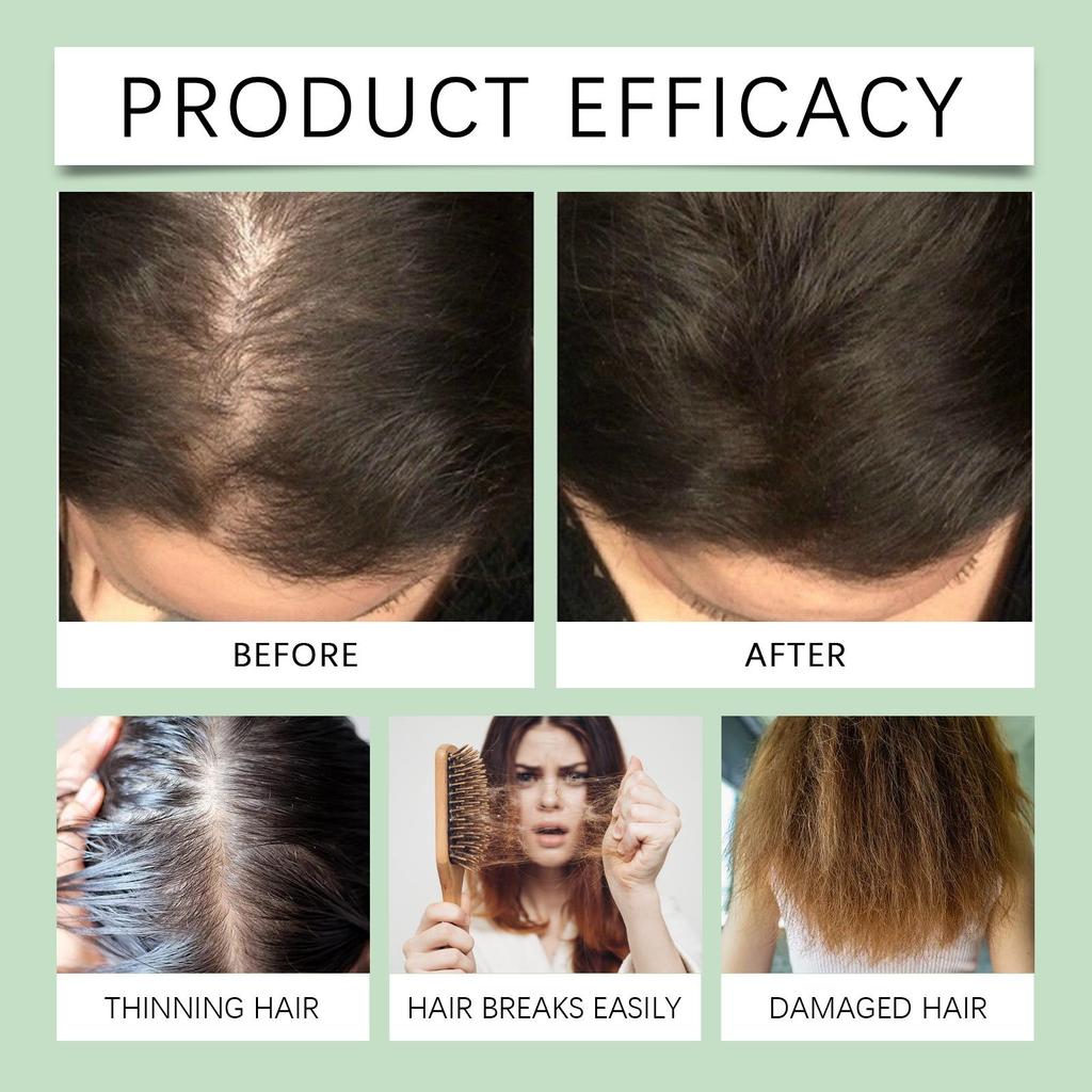 Hoegoa Rosemary Hair Care Essential Oil, moisturizing and hydrating, repairing and smoothing hair, regulating scalp oil, suitable for hair, 60ml