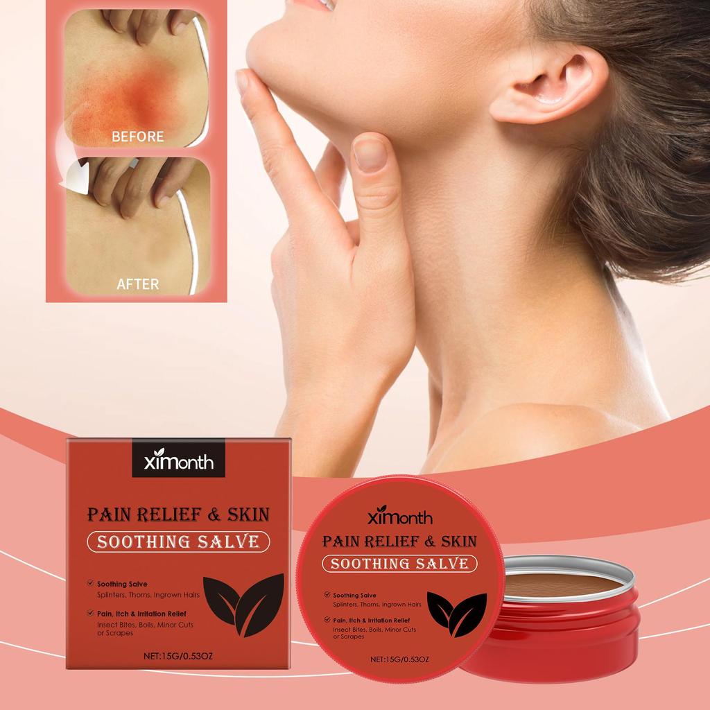 XIMONTH Hautpflegecreme Verbessert Hautbeschwerden Topische Anwendung Sanfte Feuchtigkeitspflege Haut Tägliche Pflegecreme