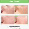TOSOWOONG - Green Tomato Pore Ampoule