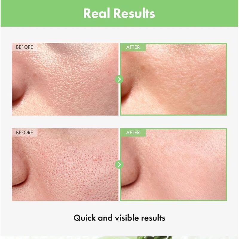 TOSOWOONG - Green Tomato Pore Ampoule