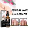 EELHOE Nail Care Serum Smooth Shine Fine Manicure Daily Nail Cleanse Care Refreshing Liquid Strengthen Nails