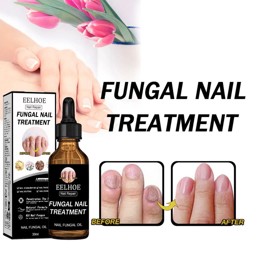 EELHOE Nail Care Serum Smooth Shine Fine Manicure Daily Nail Cleanse Care Refreshing Liquid Strengthen Nails
