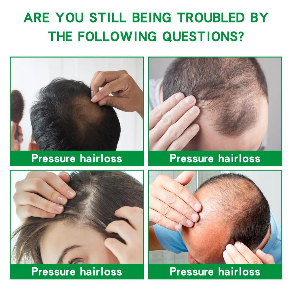 EELHOE Ginger Hair Growth Serum (30ml) - Anti-Hair Loss, Healthy Beauty, Hair Care Oil, Hair Thickening Growth Essence