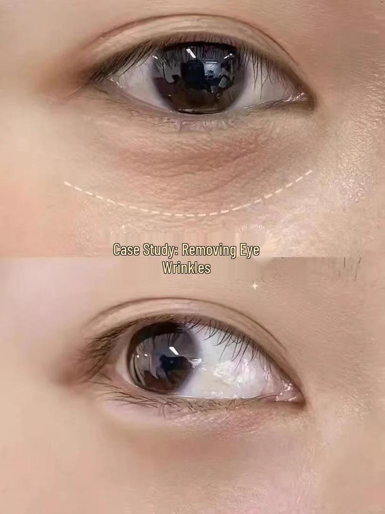 Lancôme Absolue Eye Cream for Dark Circles, Puffiness, Fine Lines, and Firming