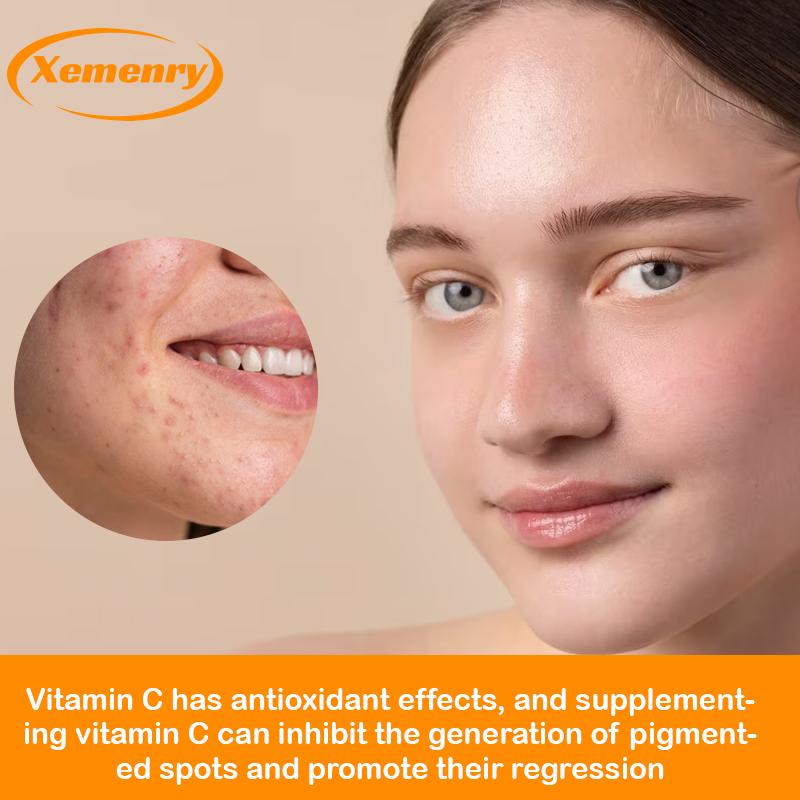 XEMENRY - 1000 mg Vitamin C - Immune system, skin health, and antioxidants