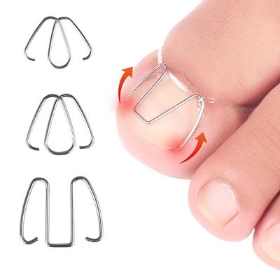 Orthopädische Nagelfalz, Orthose für eingewachsene Nägel Nagelfalz, Nägel wachsen ins Fleisch Orthopädische Nagelspange Zehennagel Positiver Nagelhaken
