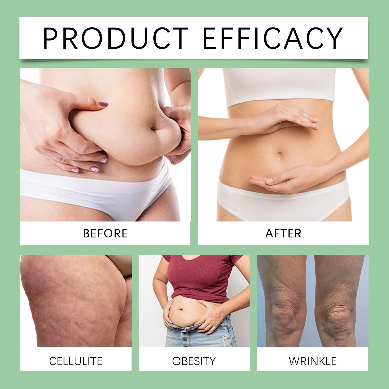 Увлажняющий и питательный массаж — фото 7