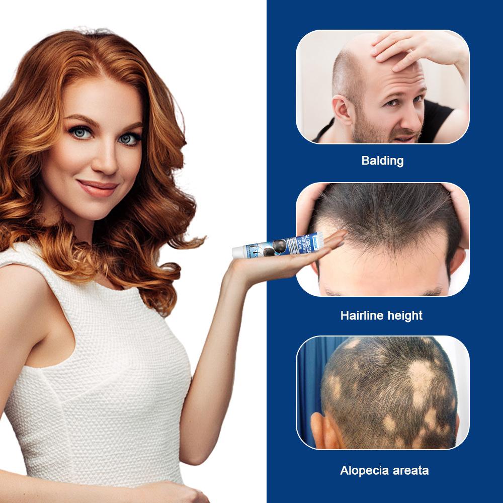 Sumifun Sophora Flavescens Balding Cream Scalp Care Hair Treatment for Men and Women Moisturizing Scalp Promote Hair Growth
