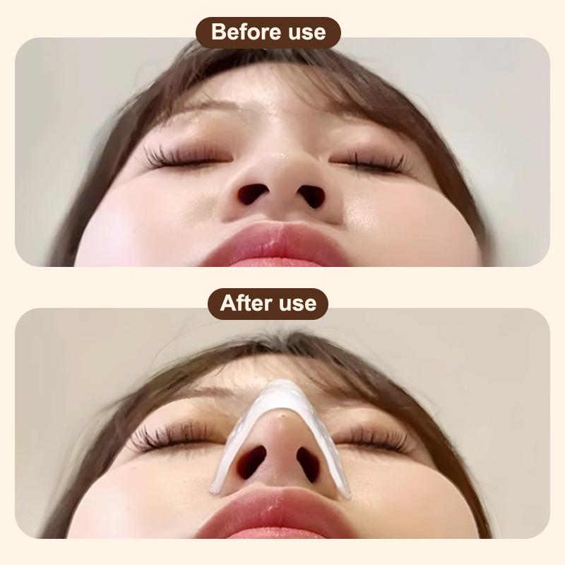 3/ 5Pcs Low Temperature Thermoplastic Nasal Splint Plastic Surgery Plastic Plate Orthopedic Orthopedic Fixator