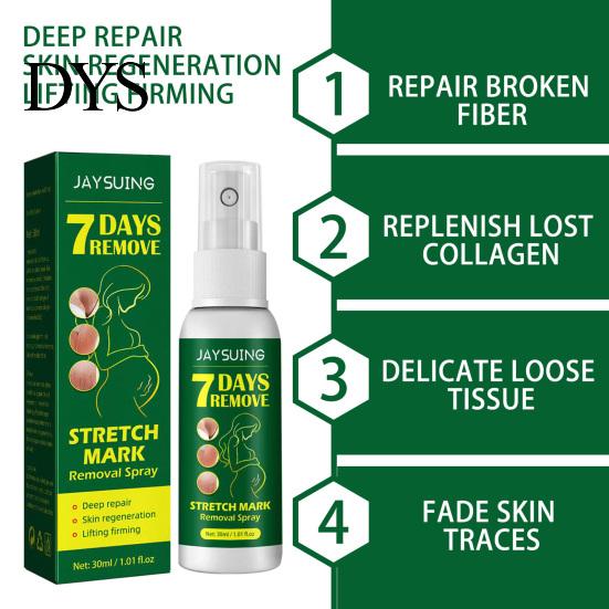 Treatment Remover 30ml Stretch Mark Spray Fast Absorption Moderate Effective Long Lasting Fade Non-Pungent Repair Damage Gentle Removal for Home Acne