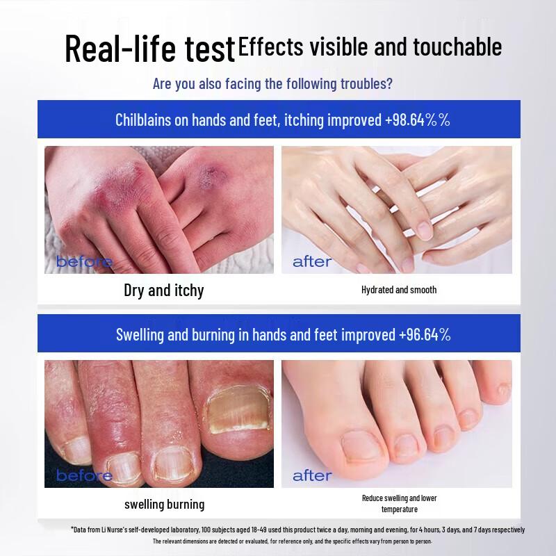 Qing Zi Tang Vaseline Hand & Foot Repair Cream