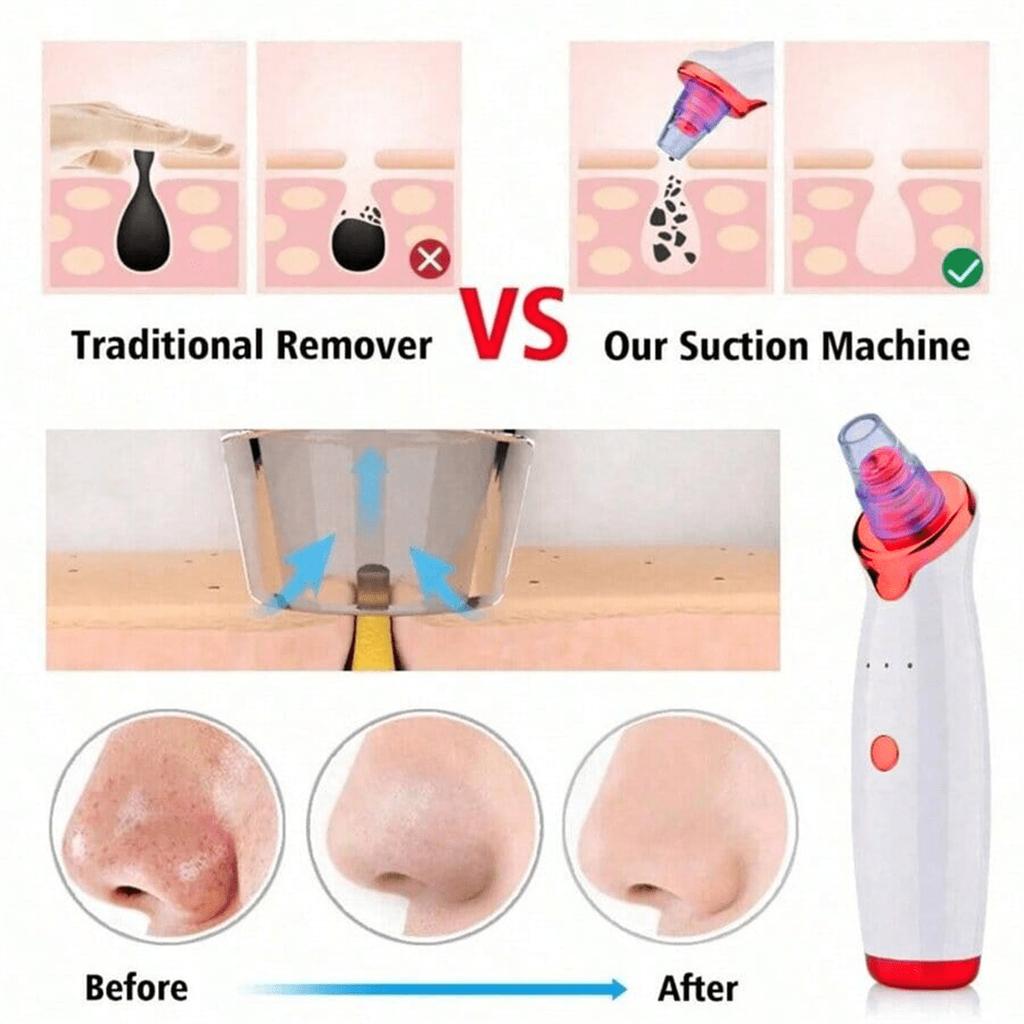 Blackhead Remover Pimple Acne Removal Blackhead Vacuum Tool Skin Care Pore Cleaner
