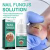 5Pcs Extra Strong Nail Fungus Treatment Serum Essence Care Repair Essence Anti Toe Infection Gel Feet Serum Removal Nails Fungal