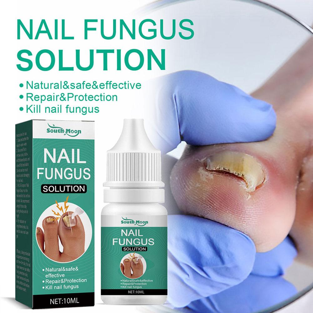 5Pcs Extra Strong Nail Fungus Treatment Serum Essence Care Repair Essence Anti Toe Infection Gel Feet Serum Removal Nails Fungal