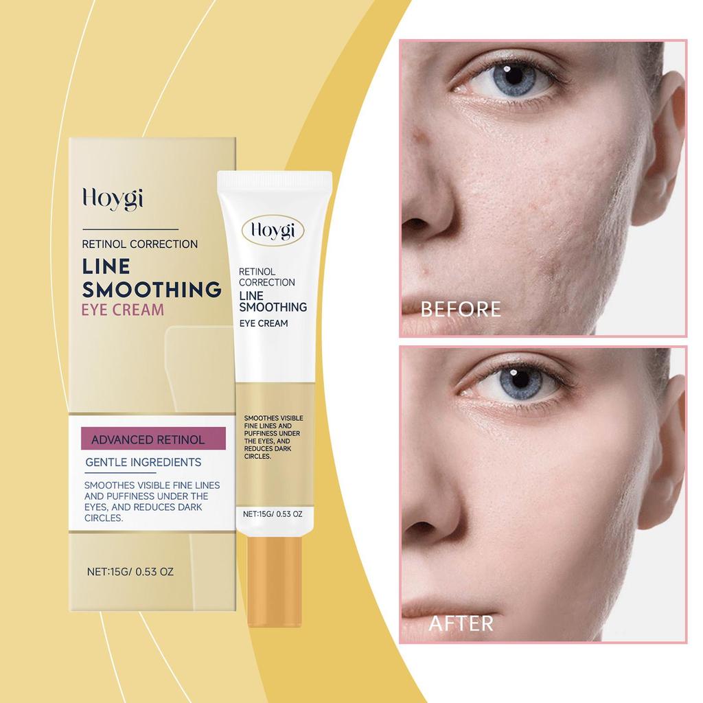 HOYGI Retinol Eye Cream Anti Dark Circles Puffiness Lightening Eyes Bags Fade Fine Lines Smoothing Brightening Lifting Skin Care