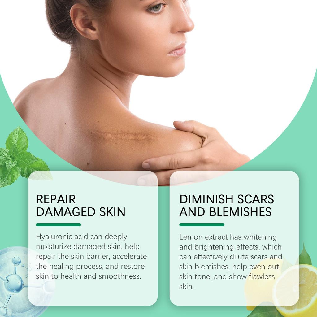 Moisturizing Rejuvenating Wiyun Body Cream Offering Superior Skin Hydration And Care 50g