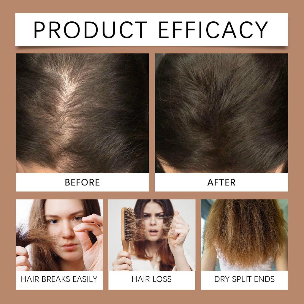 Hoegoa Moisturizing Hair Shampoo For Dry Damaged Hair Nourishing Scalp Care Smooth Strong Hair Daily Cleansing 118ML