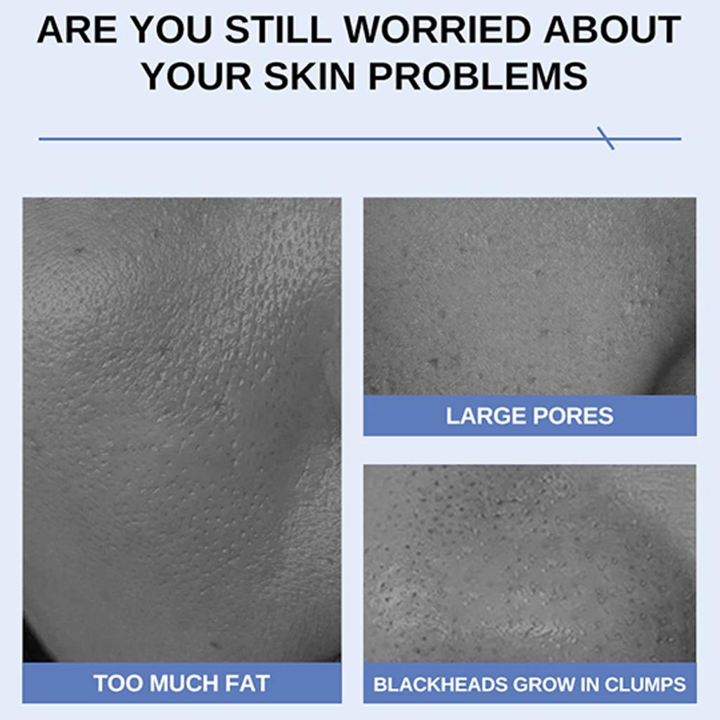 Kollagen Gelee Creme, Kapselcreme, Kollagen Auffüllcreme und sanfte Feuchtigkeitscreme erhöhen Elastizität und Feuchtigkeit