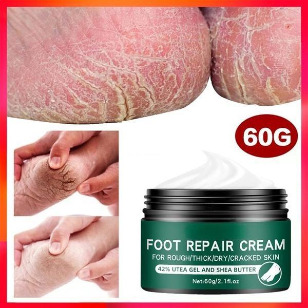 La più recente crema idratante riparatrice per la pelle delle mani e dei piedi anti-screpolature per piedi screpolati, secchi e screpolati, crema per i piedi riparatrice del tallone