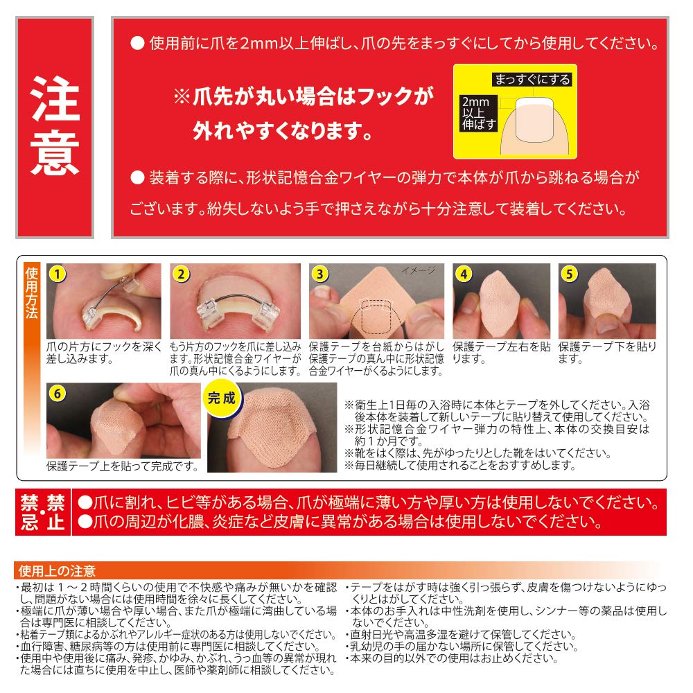 Ingrown Nail Wire Pulls Up the Shape Memory Alloy Hooks the Nail [Cyplus] Guard, Nail, Wire,