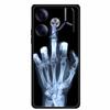 For Tecno Pova 6 Phone Case 6.78" Animal Black Silicone Soft Back Cover Cases For Tecno Pova 6 Case Pova6 Coque Funda Shockproof