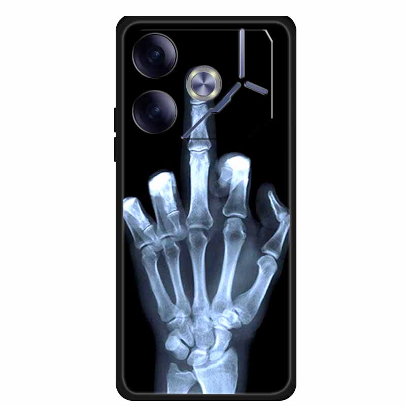 For Tecno Pova 6 Phone Case 6.78" Animal Black Silicone Soft Back Cover Cases For Tecno Pova 6 Case Pova6 Coque Funda Shockproof